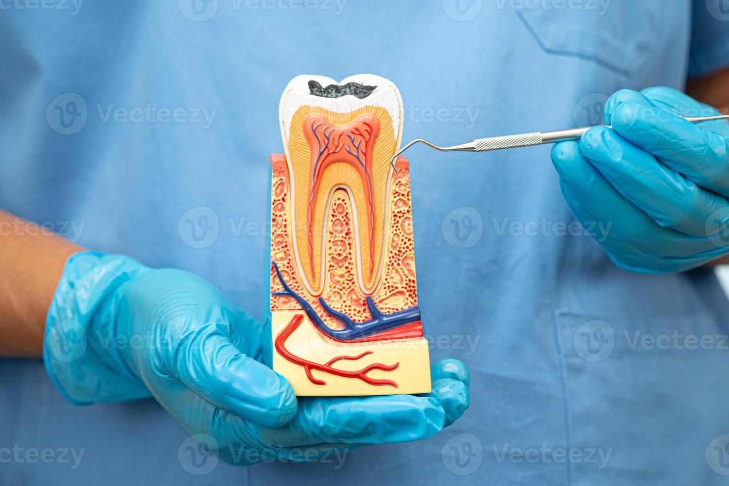 Dentist use dental instrument to check artificial tooth roots dental implant into jaw, Root canal model. photo