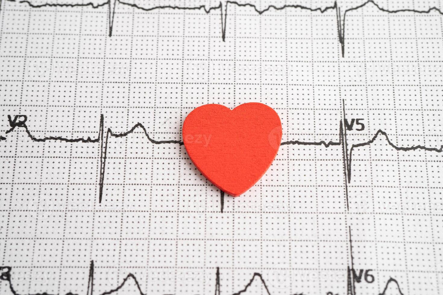 Stethoscope on electrocardiogram ECG with red heart and drug, heart wave, heart attack, cardiogram report. photo