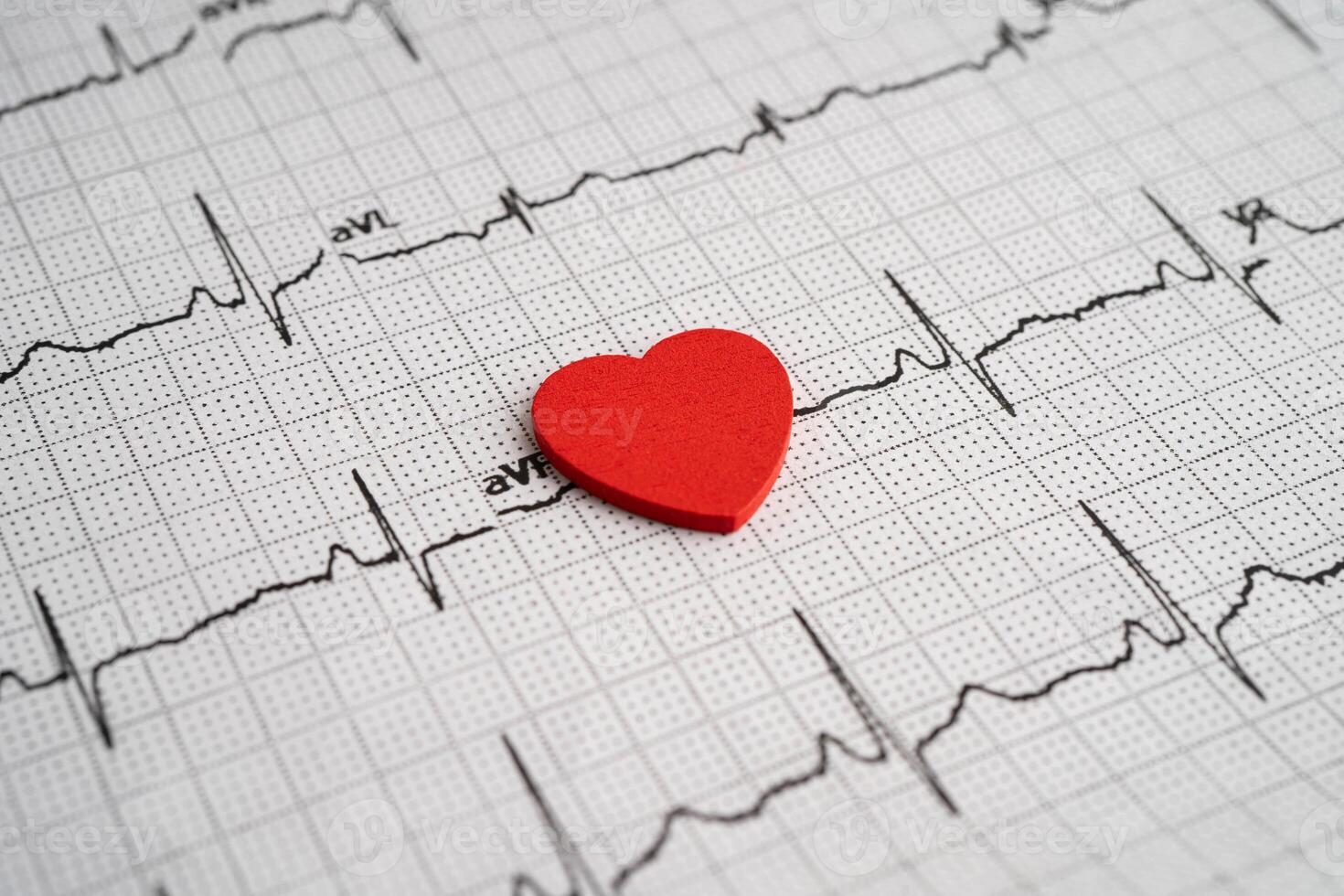 Stethoscope on electrocardiogram ECG with red heart and drug, heart wave, heart attack, cardiogram report. photo