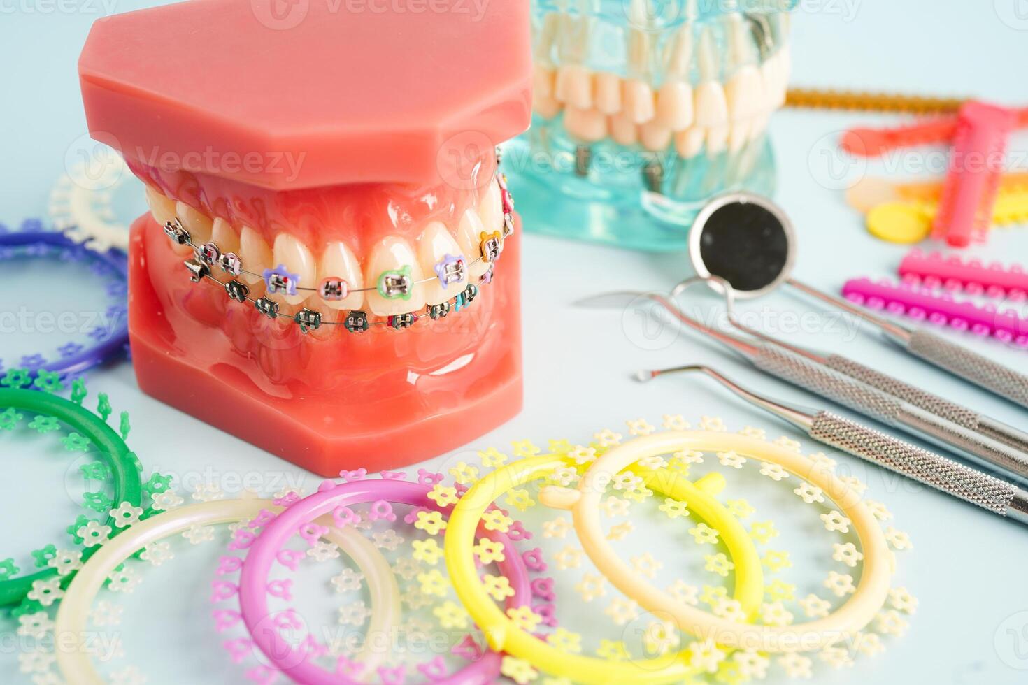 Orthodontic ligatures rings and ties, elastic rubber bands on orthodontic braces, model for dentist studying about dentistry. photo