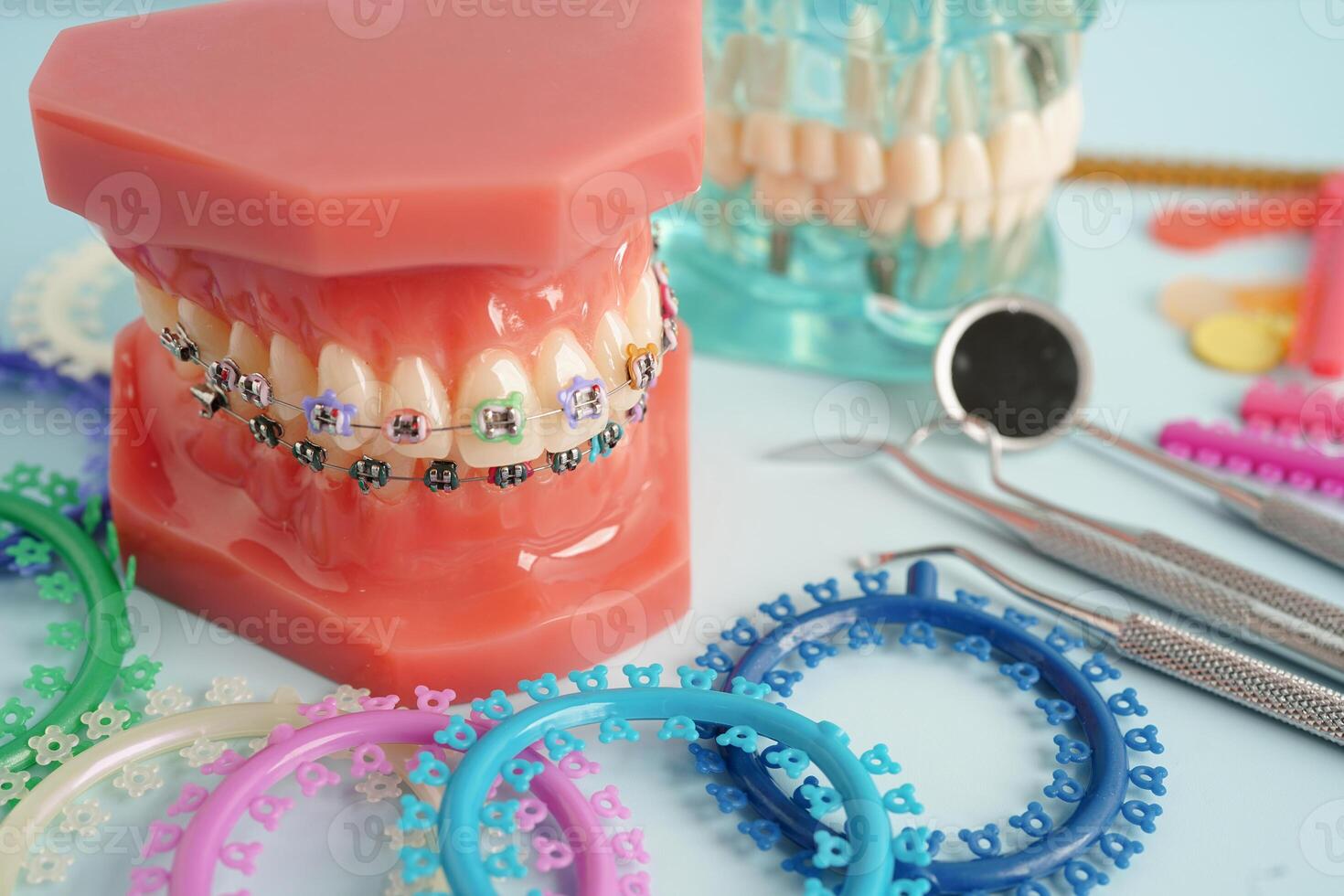 Orthodontic ligatures rings and ties, elastic rubber bands on orthodontic braces, model for dentist studying about dentistry. photo