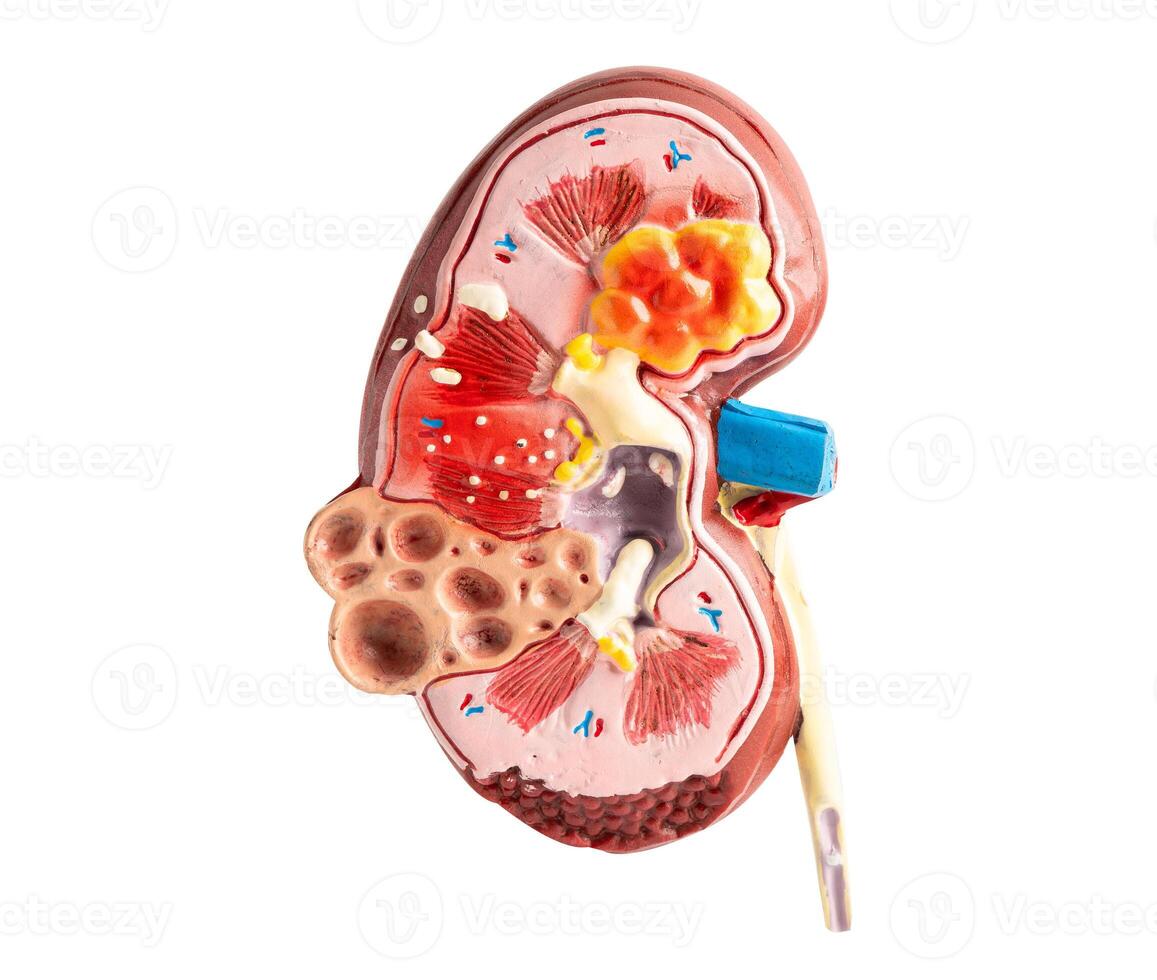Model of human kidney isolated on white background with clipping path, Chronic Kidney Disease CKD. photo