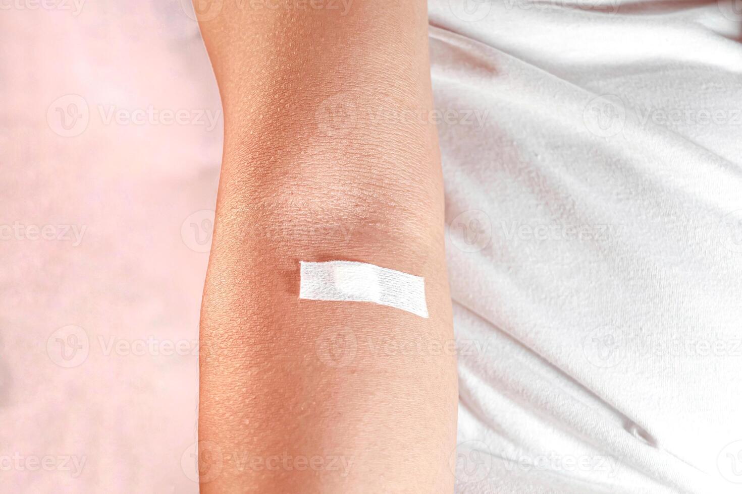 showing injection marks, concept of blood donor photo
