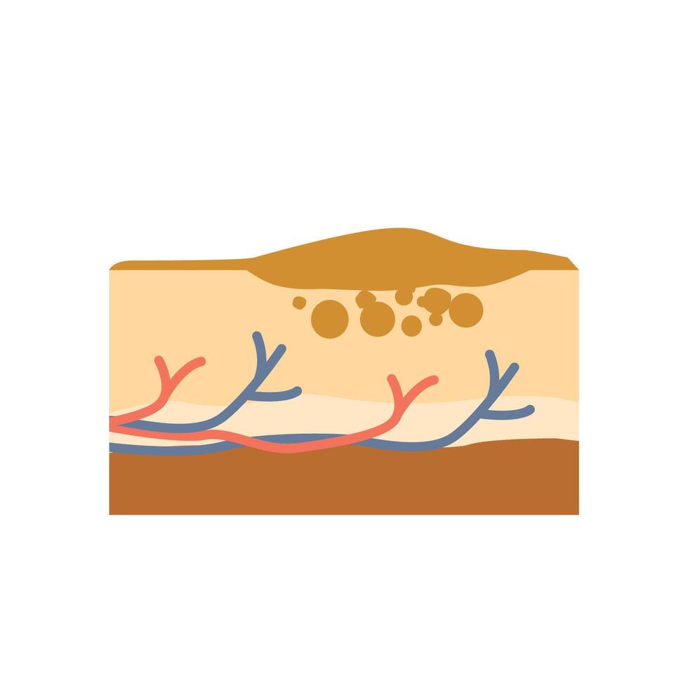 skin illustration in flat style, body parts design of internal organs. vector