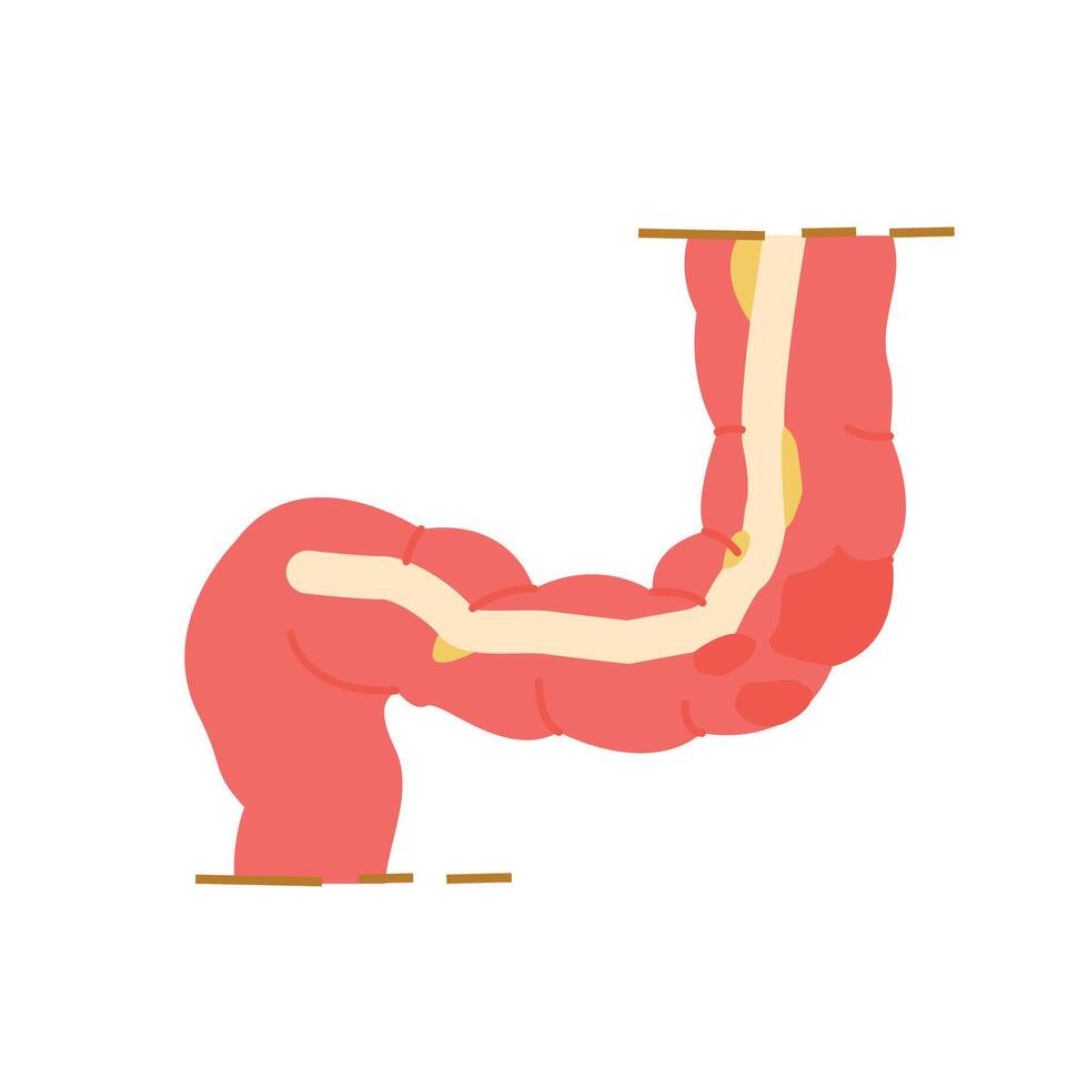 Intestine illustration in flat style, body part design of internal organs. vector
