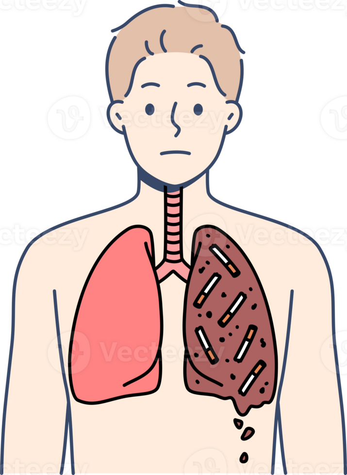 Man smoker with destroyed lungs is forced to suffer due to addiction of tobacco and nicotine. Guy who smokes needs surgery due to smoking for long time and lack of willpower for fight bad habit. png