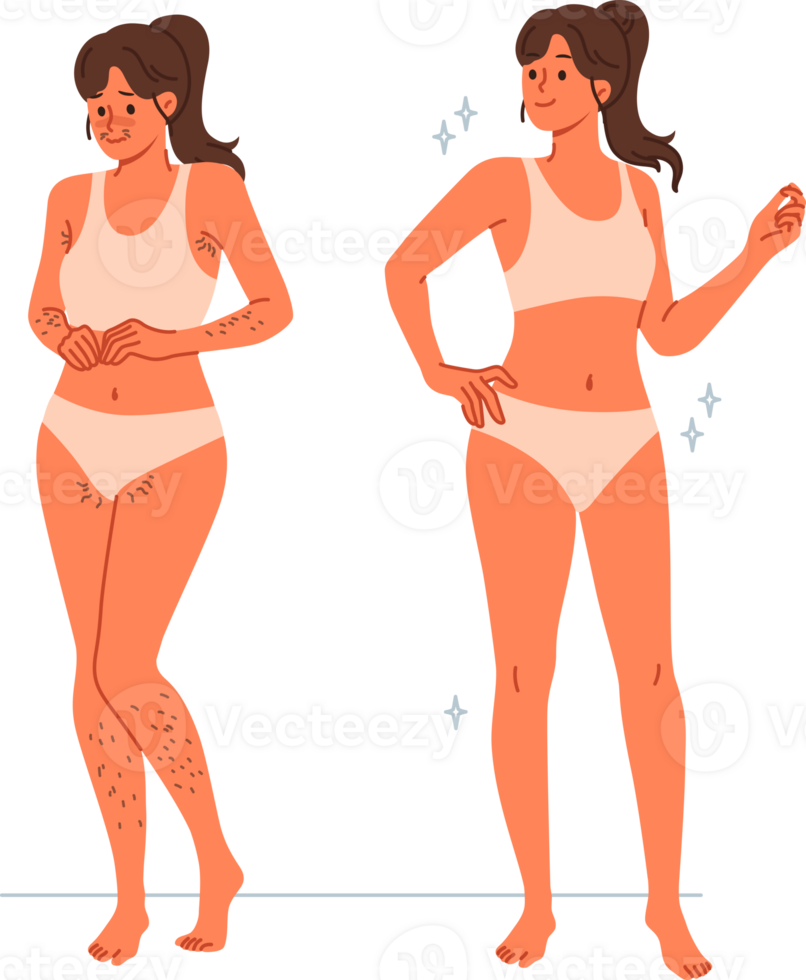 Girl uses depilation and laser hair removal, demonstrating result of visit to cosmetologist. Young woman recommends depilation of legs and face or bikini area using sugaring or hot wax png