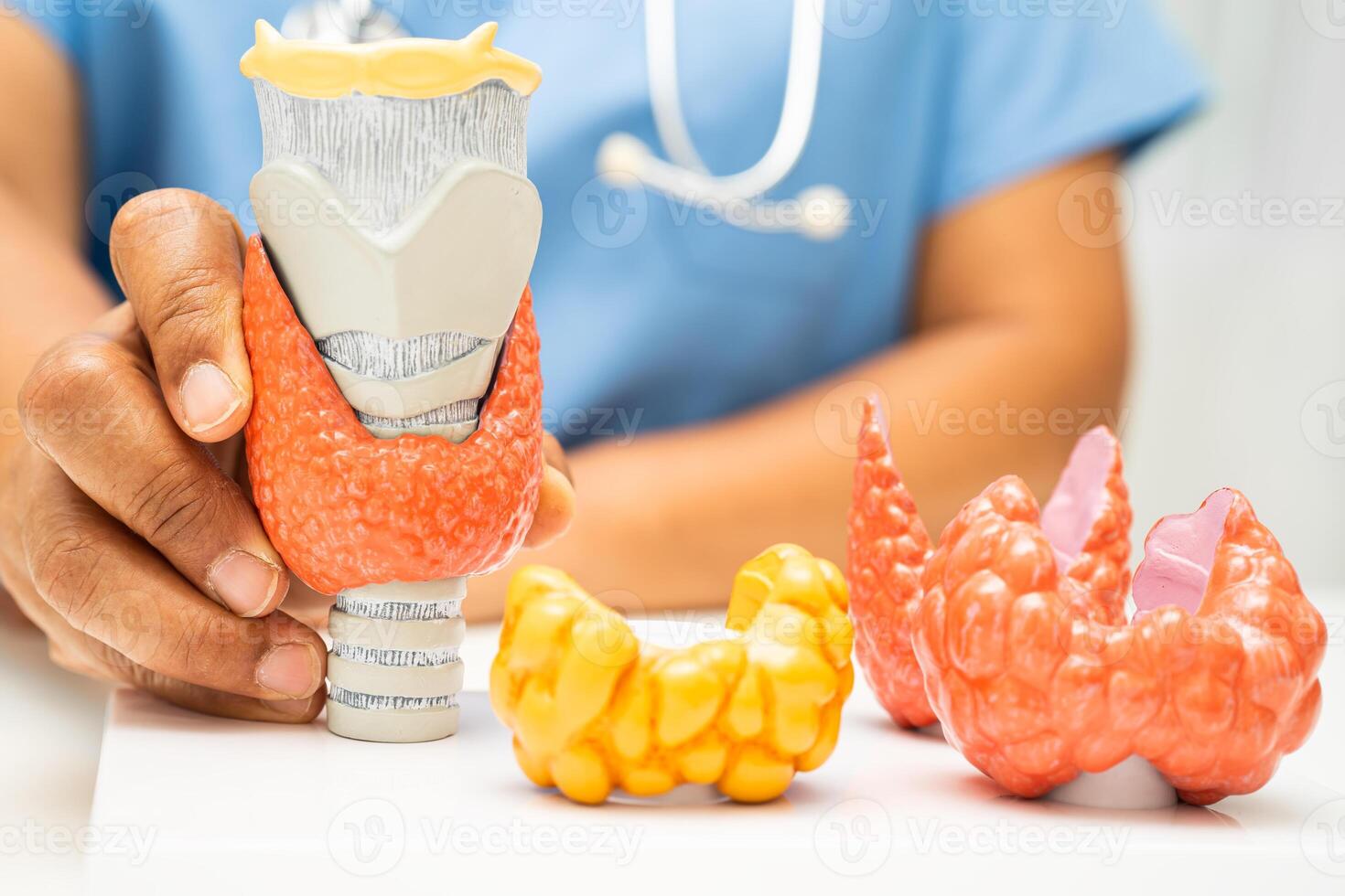 Hyperthyroidism, Overactive Thyroid, Thyroid Lymphoma, Asian doctor with thyroid gland human anatomy model in hospital. photo