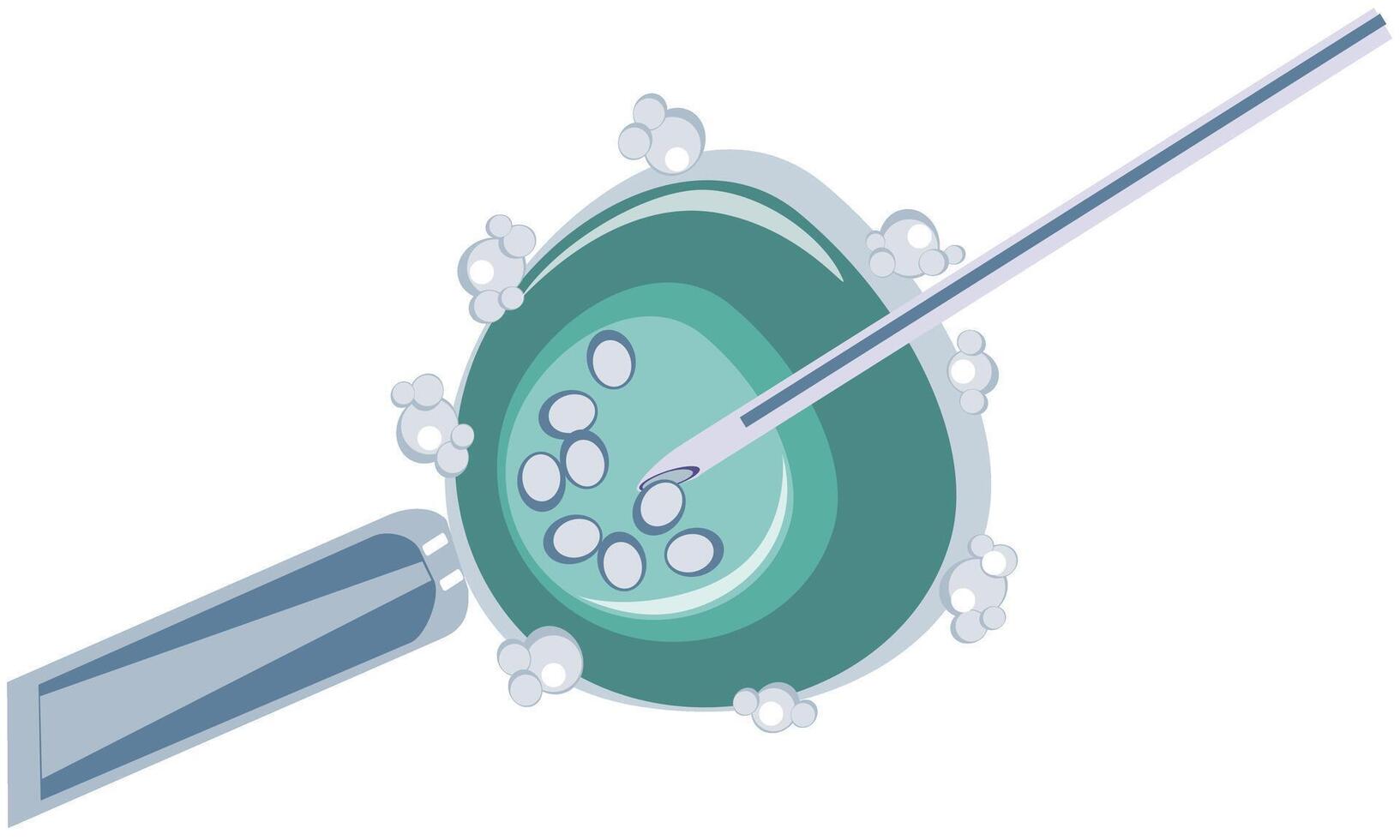 Transvaginal puncture of follicles, IVF vector