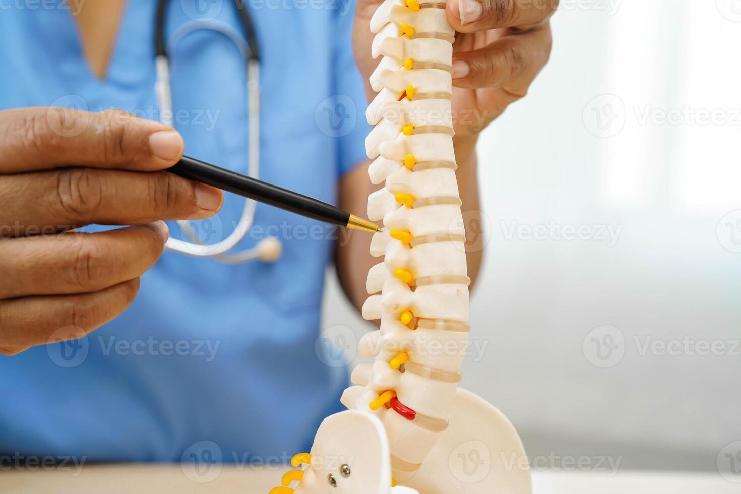 Asian doctor holding spinal nerve and bone model, Lumbar spine displaced herniated disc fragment for treatment medical in the orthopedic department. photo