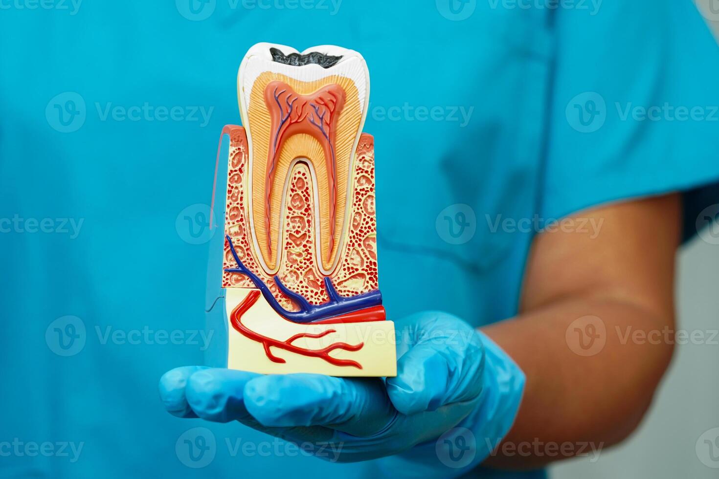 Dentist holding dental implant, artificial tooth roots into jaw, root canal of dental treatment, gum disease, teeth model for dentist. photo