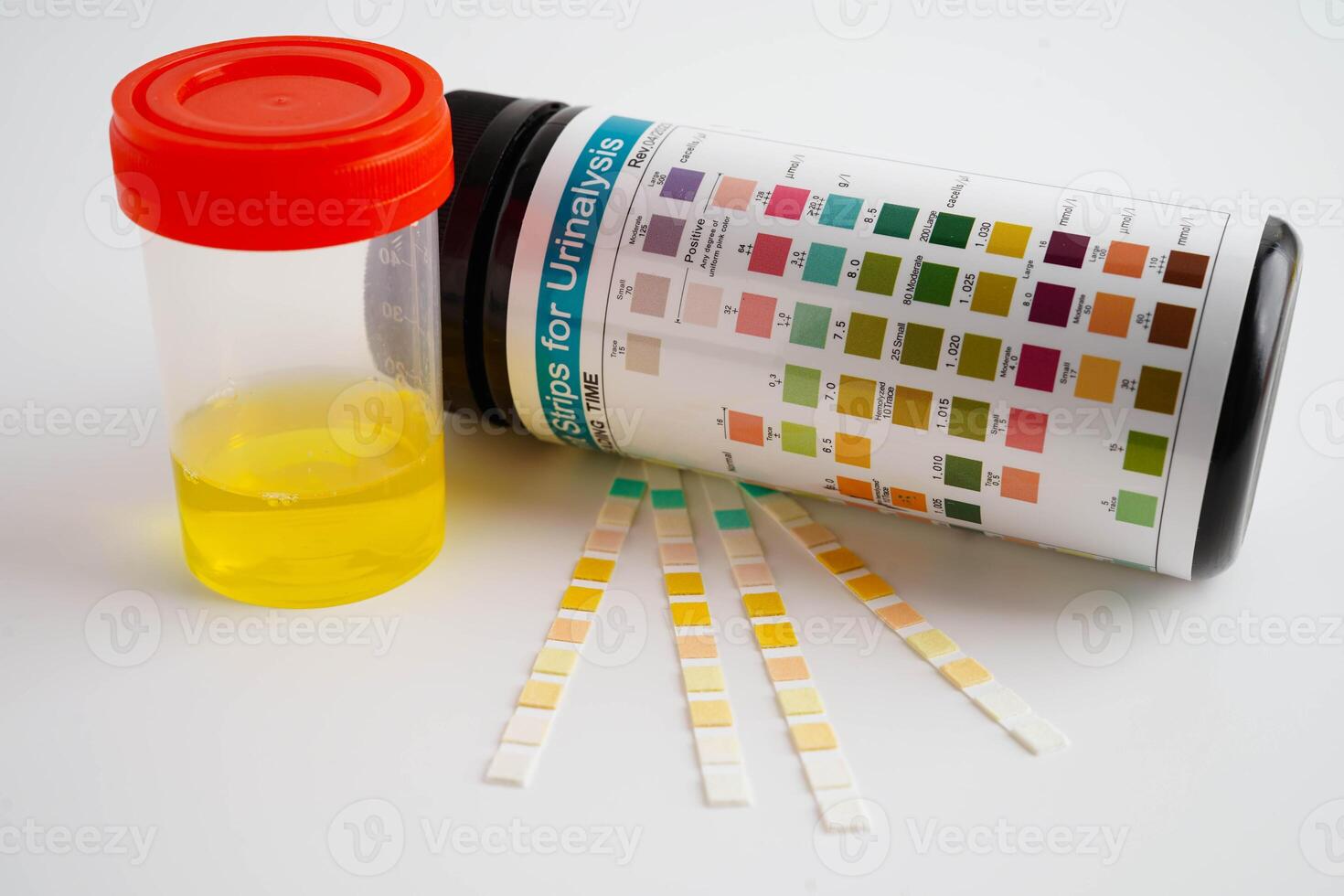 Urinalysis, urine cup with reagent strip pH paper test and comparison chart in laboratory. photo
