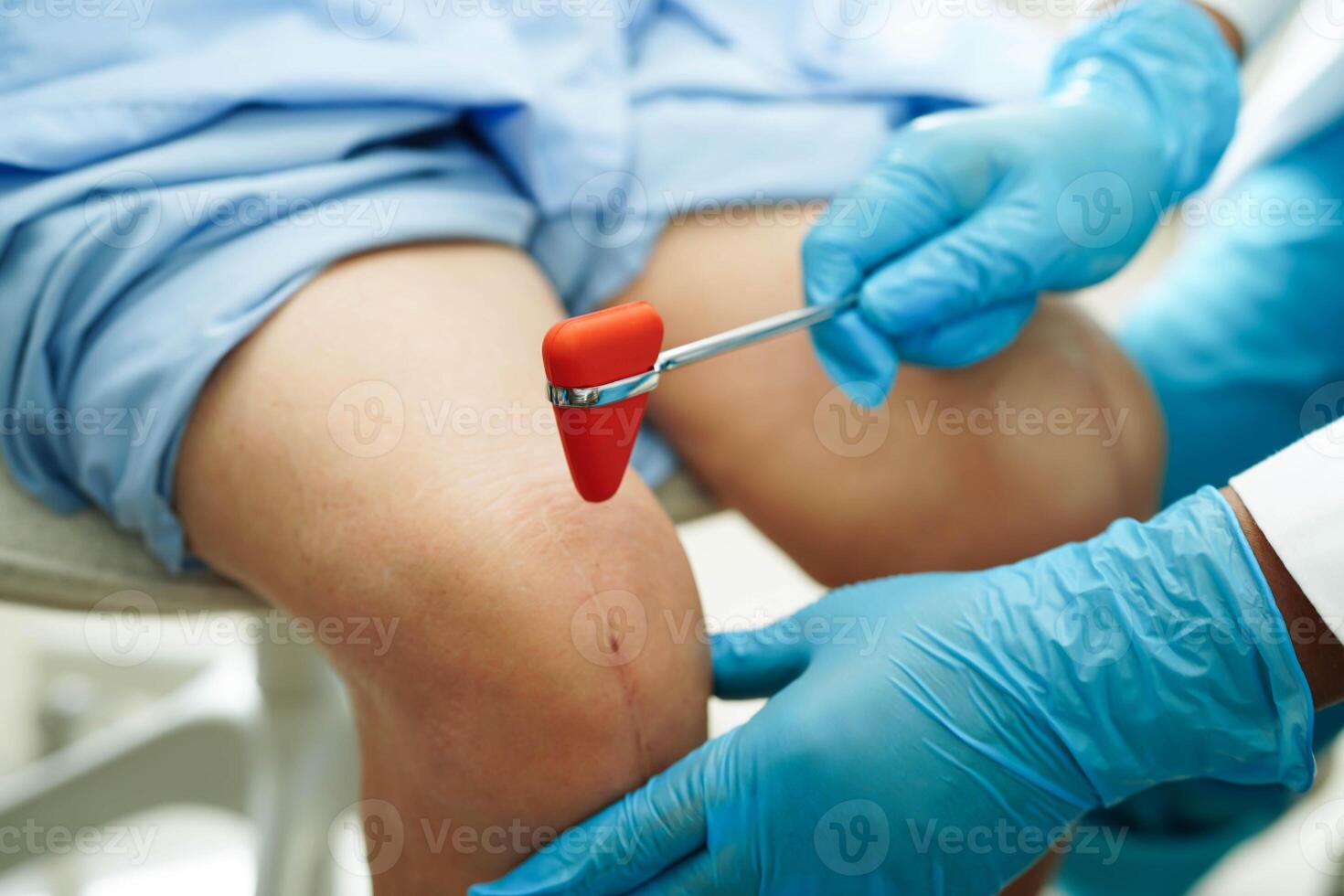 Asian doctor knock on knee reflex nerve for check and treatment senior patient in hospital. photo
