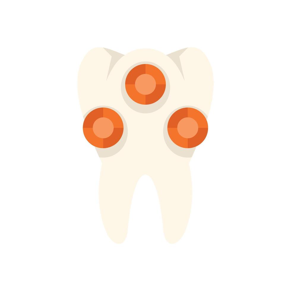 Tooth decay showing enamel damage illustration vector