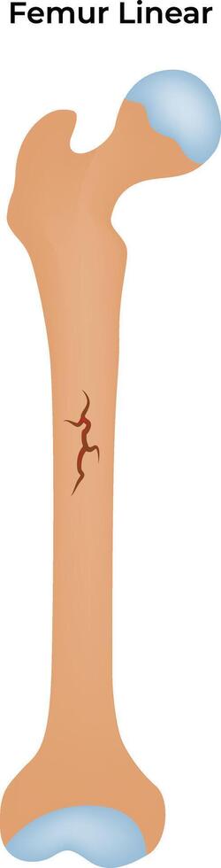 Femur Linear Colorful Illustration vector