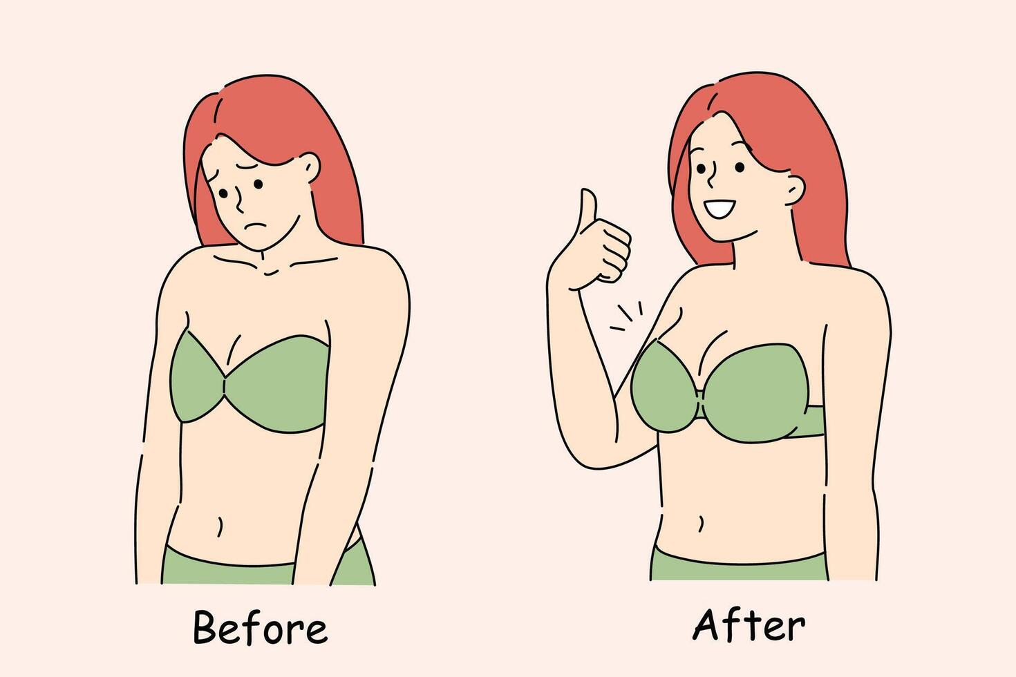 Woman who has had breasts enlarged through implantation and plastic surgery stands in bikini vector