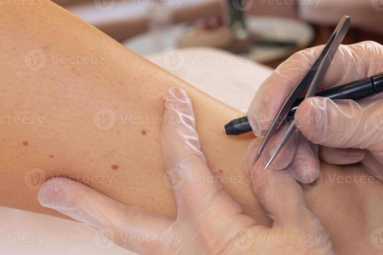 Health professional marking skin for a medical procedure at a clinical setting photo
