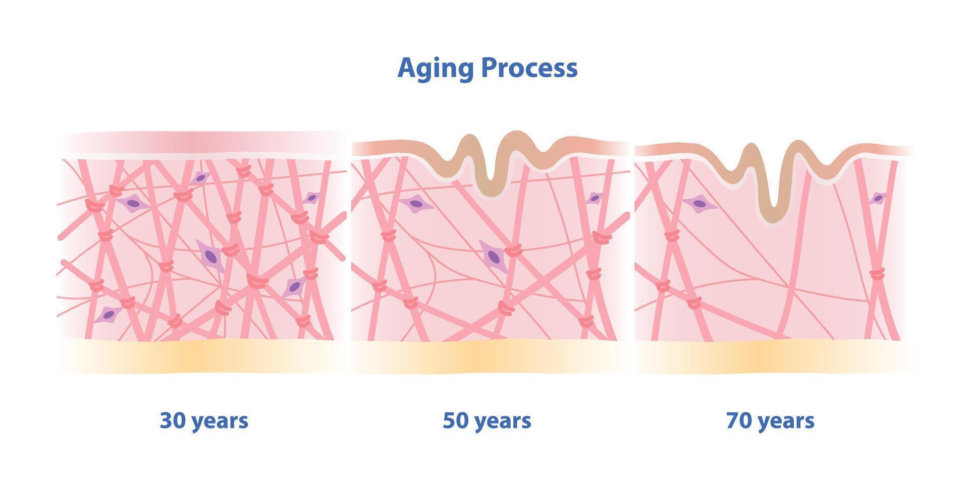 Cross section of aging process skin comparison illustration isolated on white background. High density, depletion and low density of collagen, elastin fibers and fibroblasts in the dermis. vector