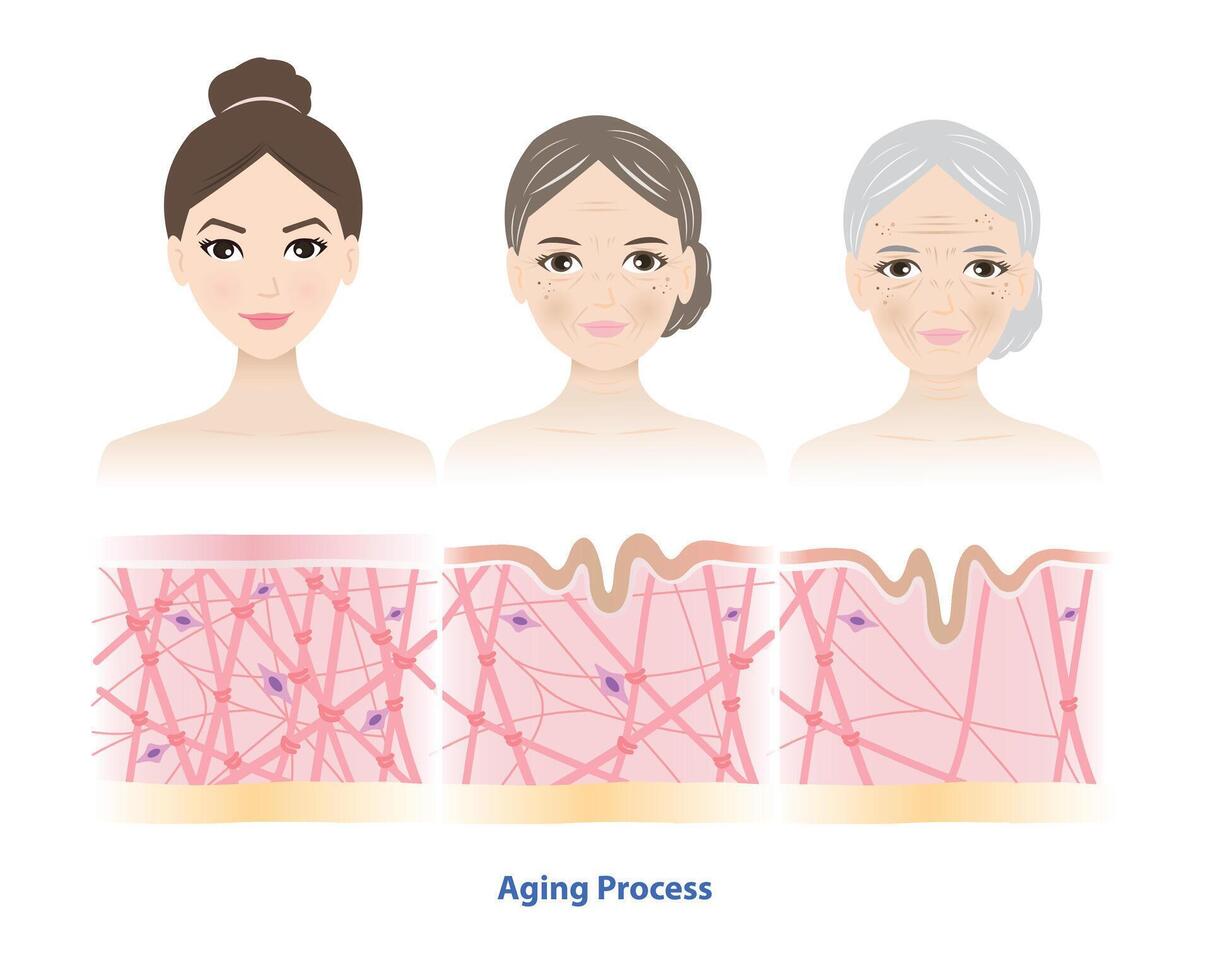 Aging process comparison with 3 generation women face illustration. Cross section of high density, depletion and low density of collagen, elastin fibers and fibroblasts in the dermis. vector