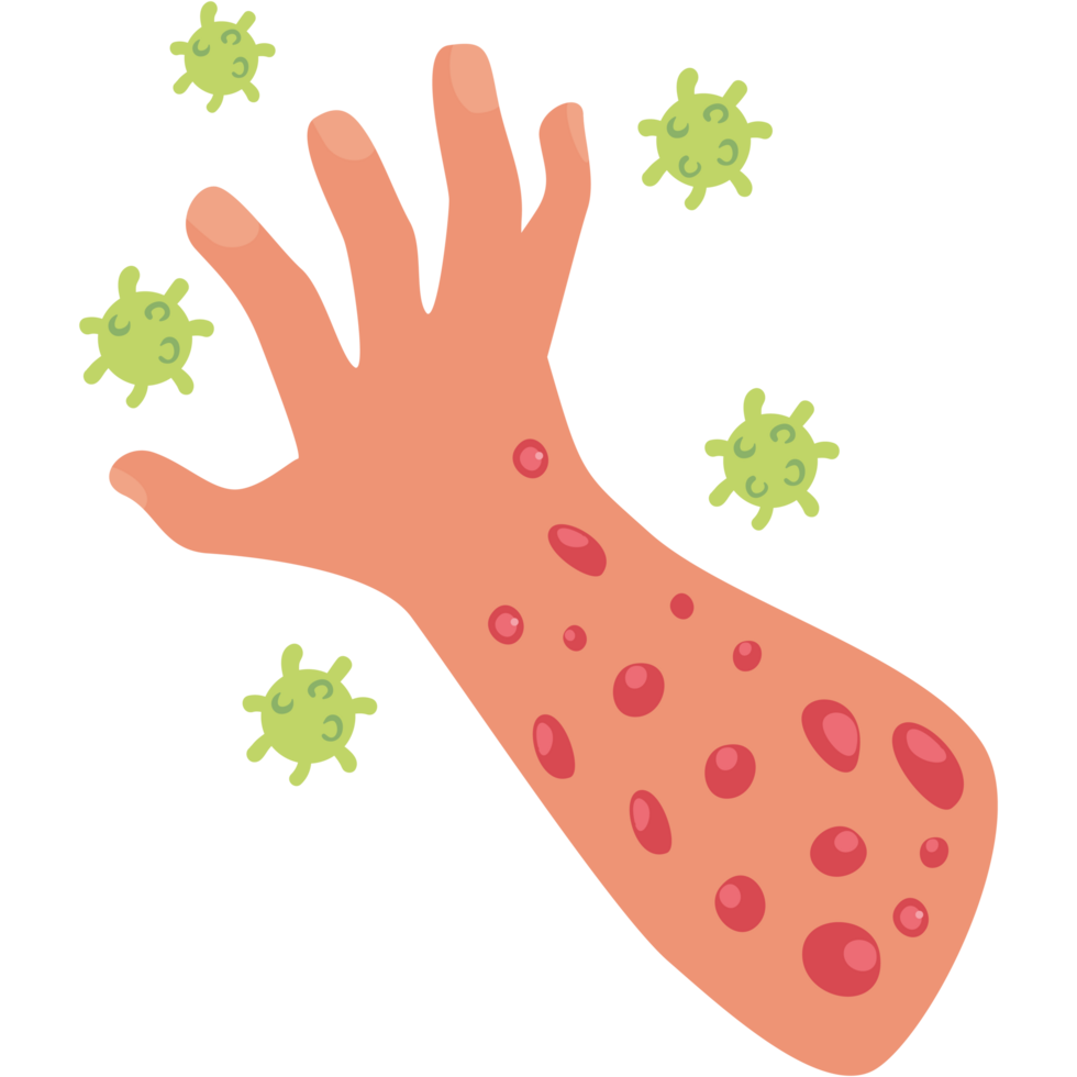 monkeypox virus hands png