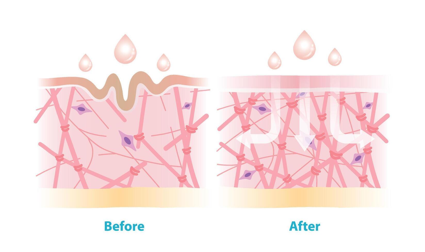 Before and after the skincare rejuvenate collagen and elastin in dermis illustration on white background. Cross section of wrinkles skin and skincare absorbing to help restore aging skin. vector