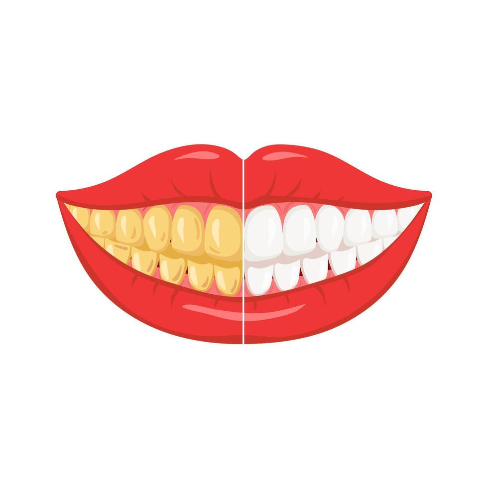 Teeth whitening before and after vector