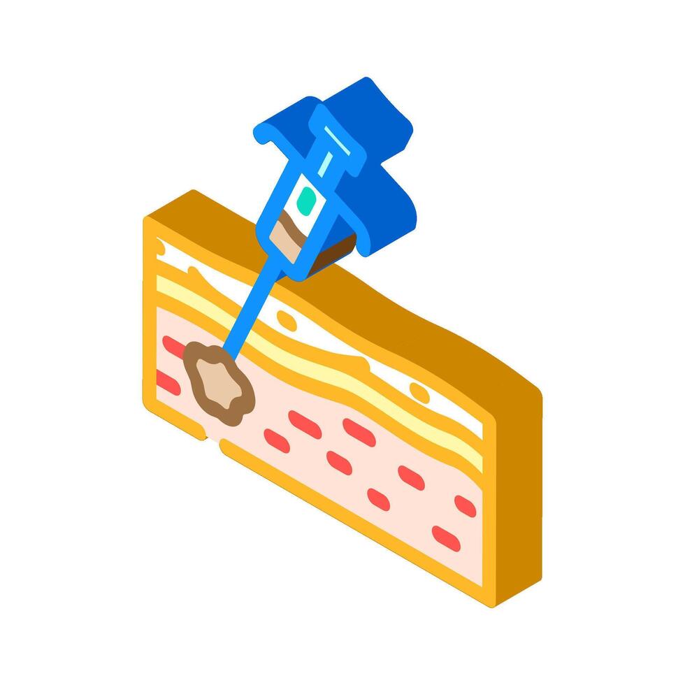 biopsy cancer treatment isometric icon illustration vector