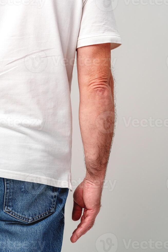 A close-up view of a man's bare hand resting against his side photo
