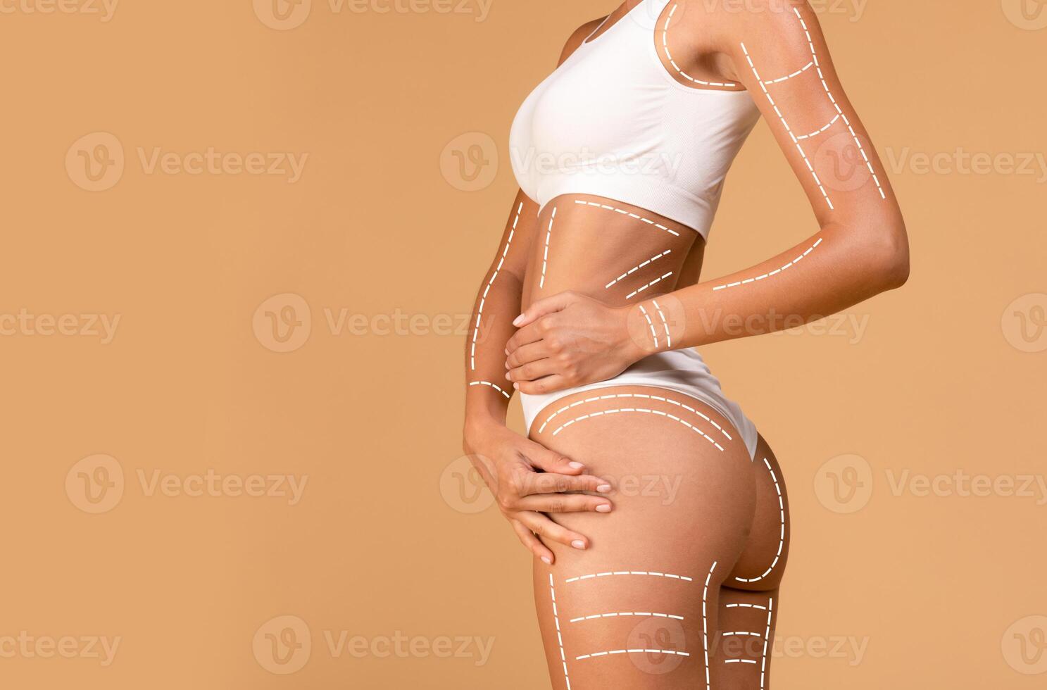 Lifting and tightening concept. Young lady in white top and panties posing with massage lines and arrows on her body over beige studio background, free space photo