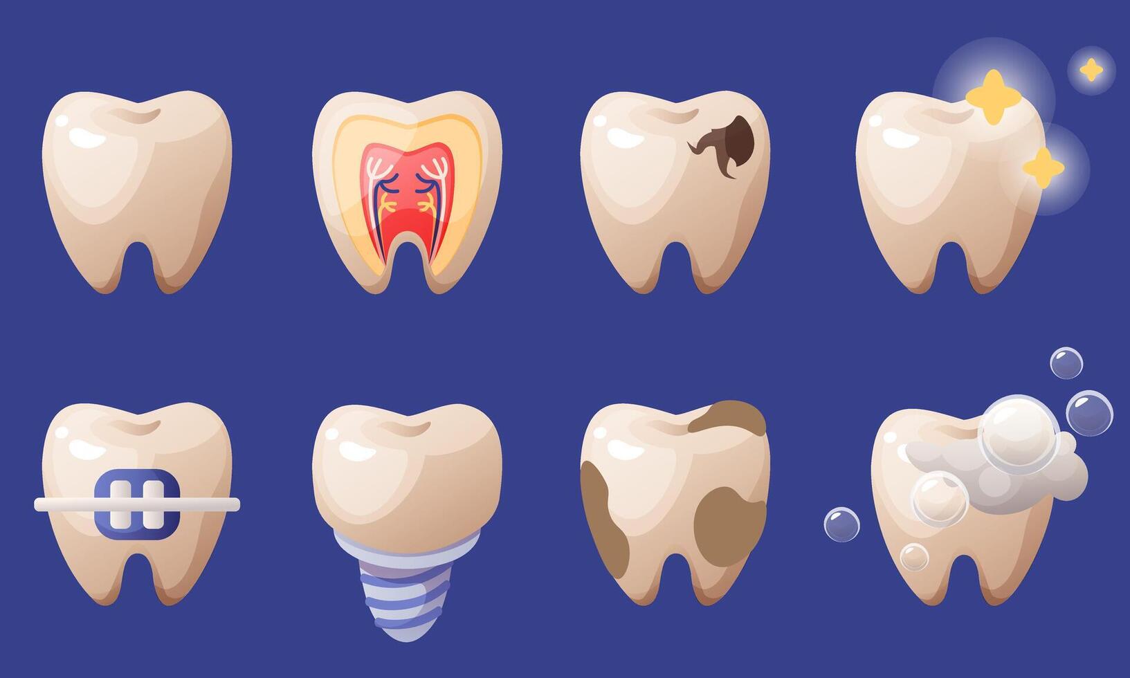set of teeth. Dental problems, caries, tartar, plaque, implants, orthodontic braces. Plaque on teeth, shiny white teeth. Oral hygiene and toothache, cavities, rubbing, stains and healthy teeth. vector