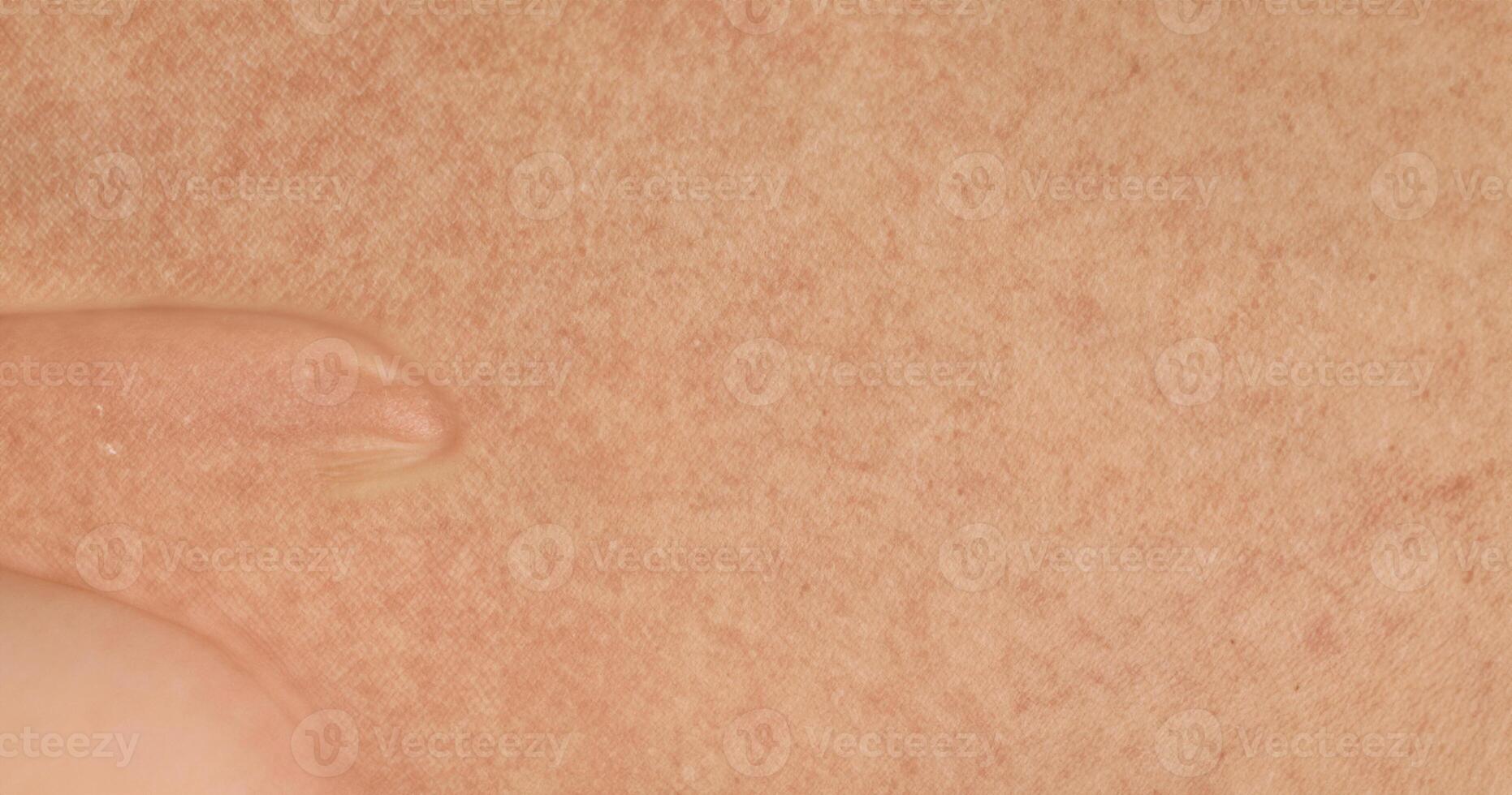 Detailed close-up of human skin texture, showcasing natural pores and fine lines. photo