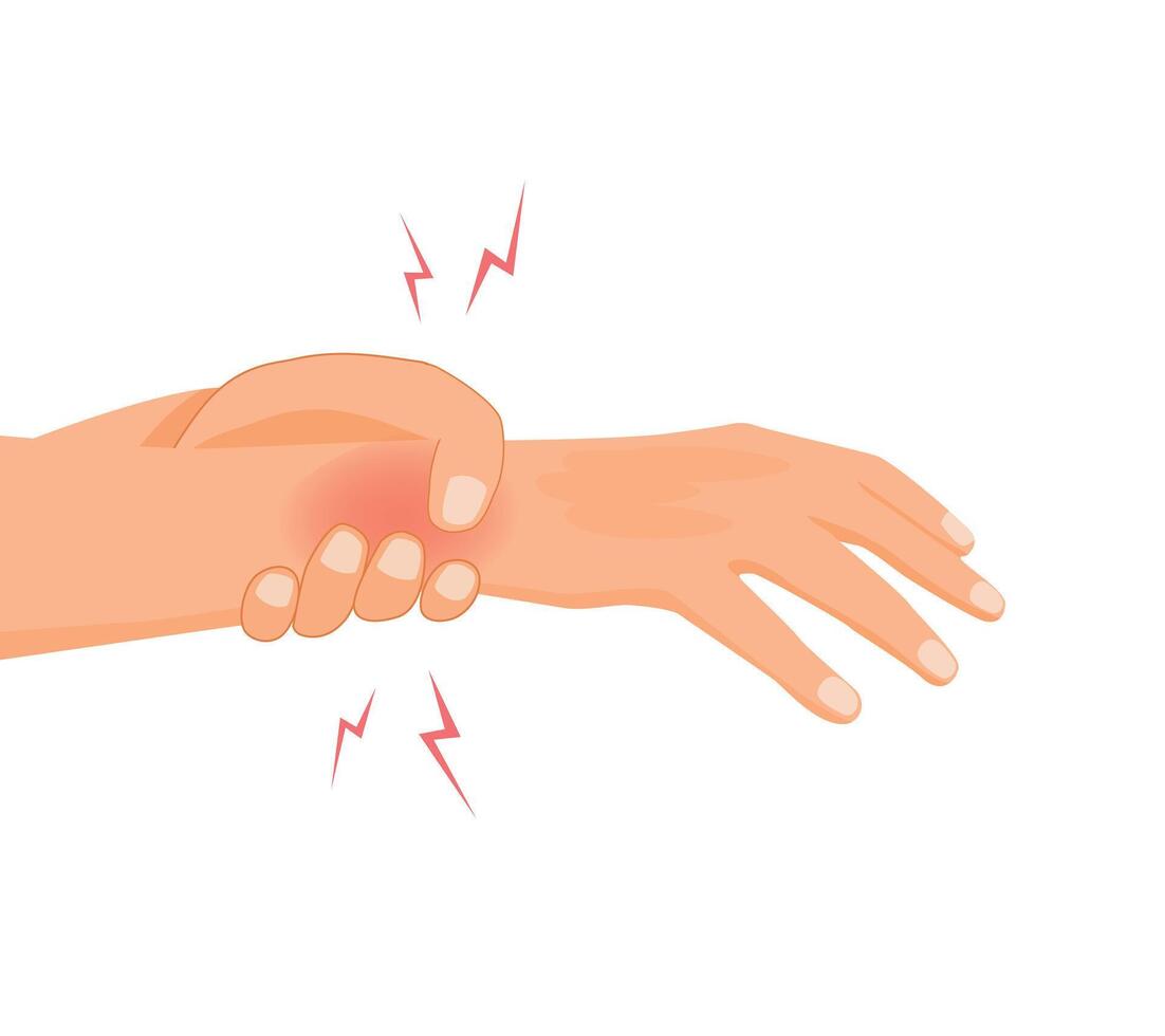 Wrist injury with carpal tunnel syndrome vector
