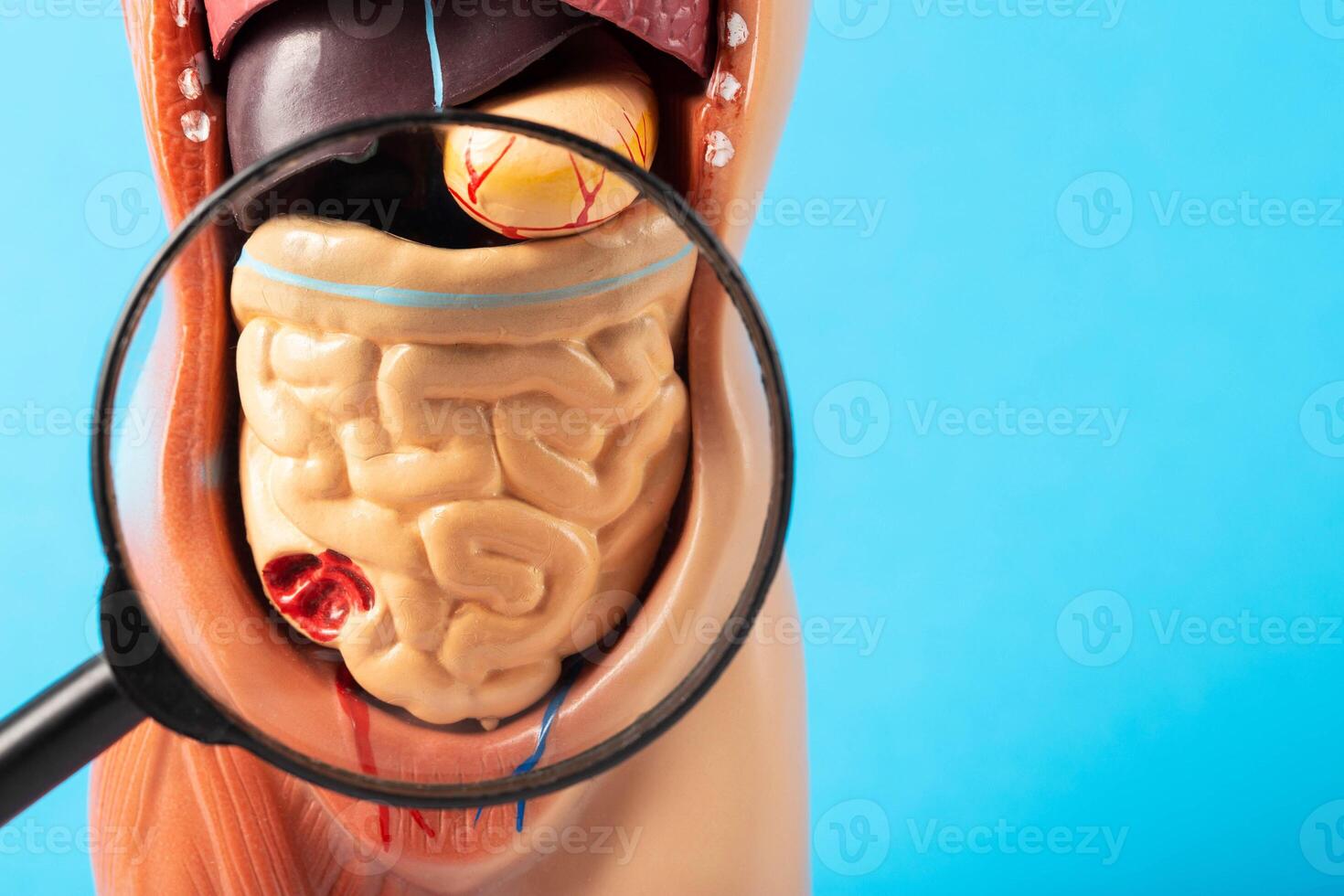 Mockup of a man with internal organs and intestines under a magnifying glass on a blue background. Concept of intestinal diseases and treatment, cancer and intestinal polyps. Flatulence and bloating. photo