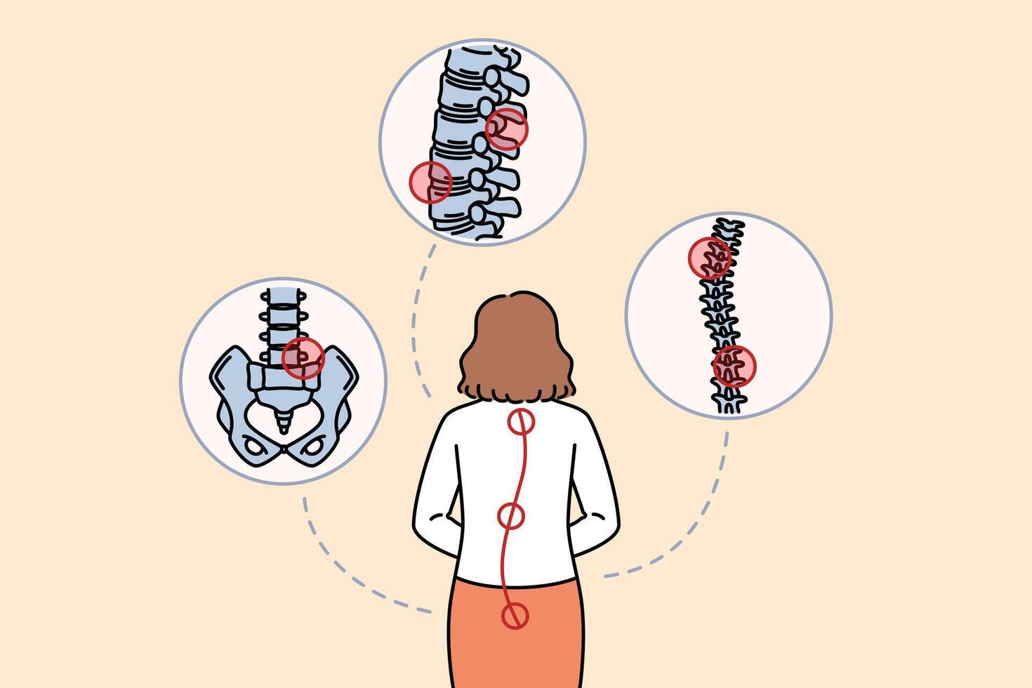 Woman with sore spine stands with back to camera and needs help of massage therapist or osteopath vector