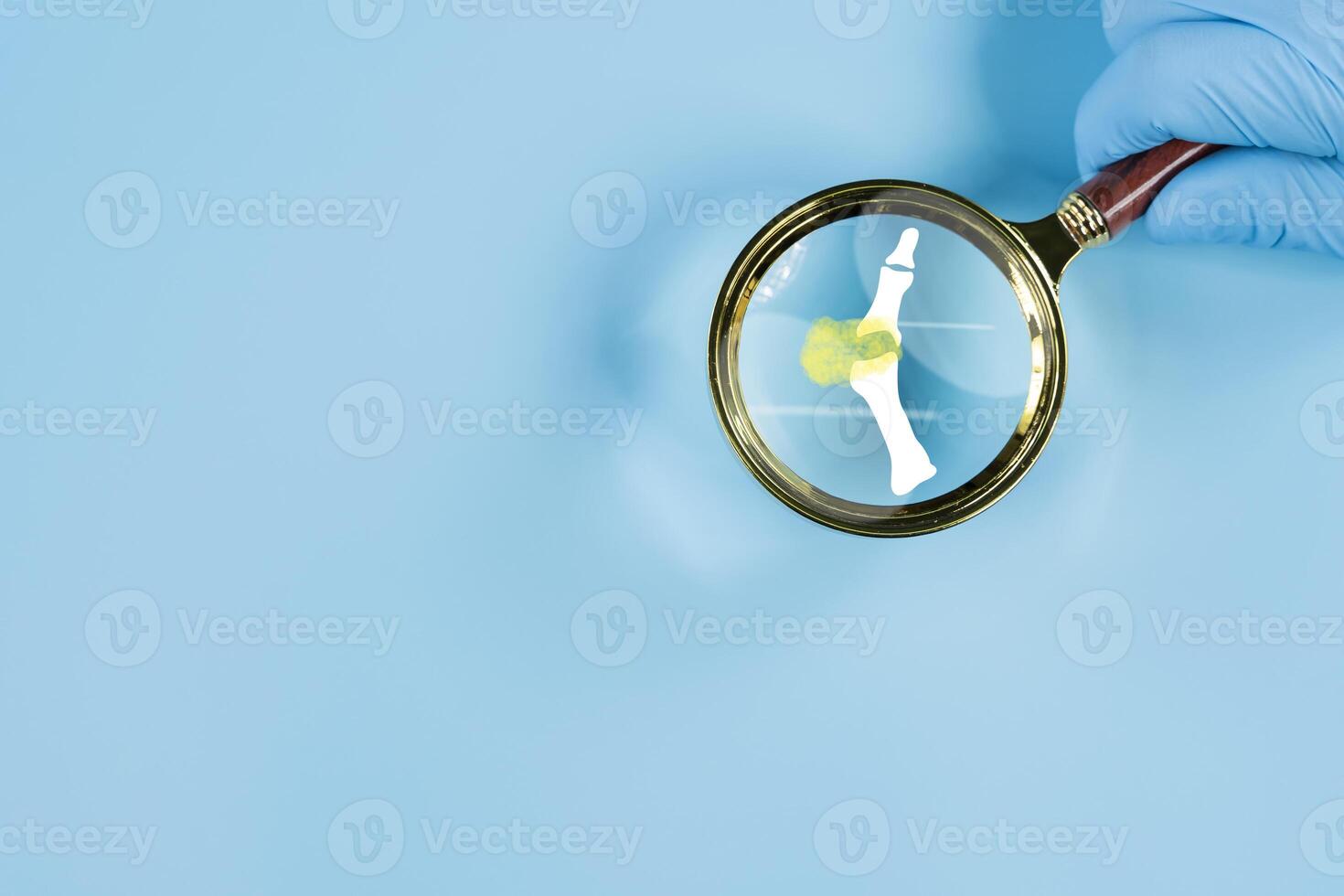 Gout. Close-up of joint with inflammatory arthritis. Human foot skeleton bones through magnifying glass isolated photo
