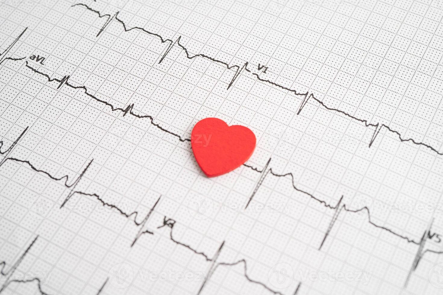 Electrocardiogram ECG, heart wave, heart attack, cardiogram report. photo