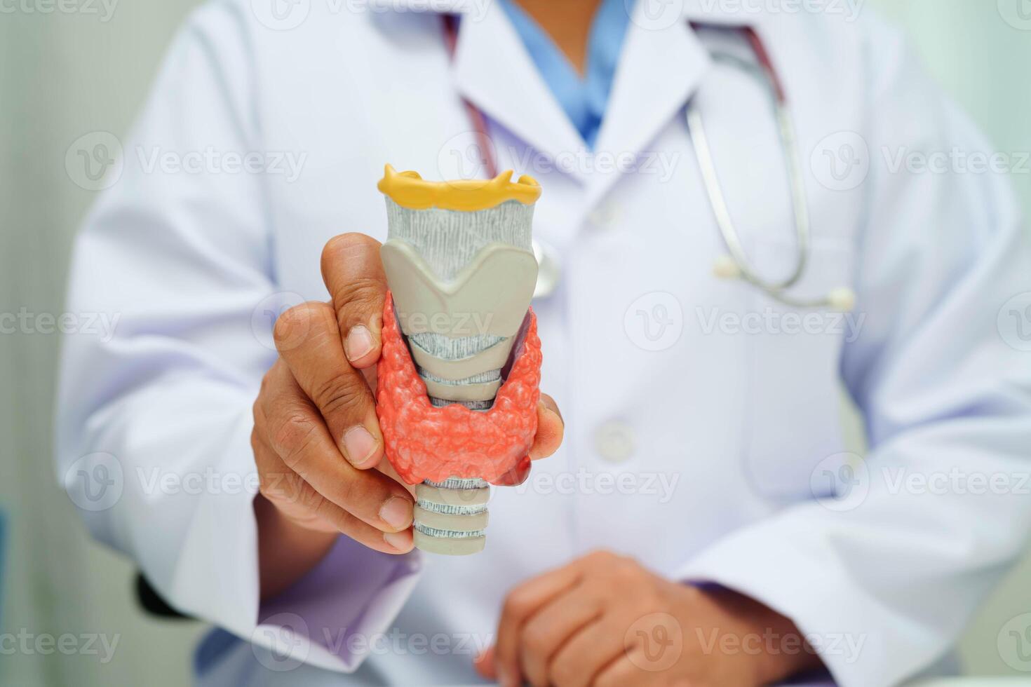 Hyperthyroidism, Overactive Thyroid, Thyroid Lymphoma, Asian doctor with thyroid gland human anatomy model in hospital. photo