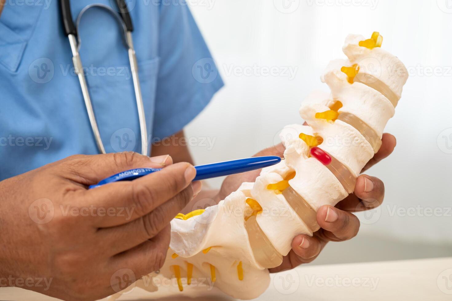 Doctor with lumbar vertebra bone skeleton and nerve model for treatment in the orthopedic department. photo