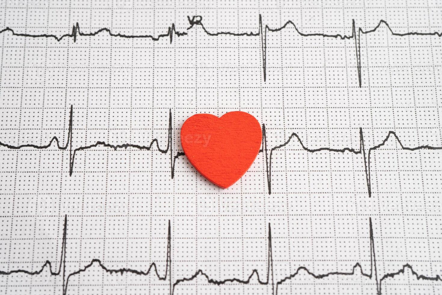 Red heart on electrocardiogram ECG with red heart, heart wave, heart attack, cardiogram report. photo