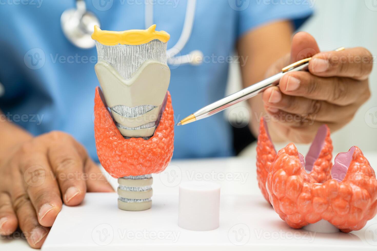 Hyperthyroidism, Overactive Thyroid, Thyroid Lymphoma, Asian doctor with thyroid gland human anatomy model in hospital. photo