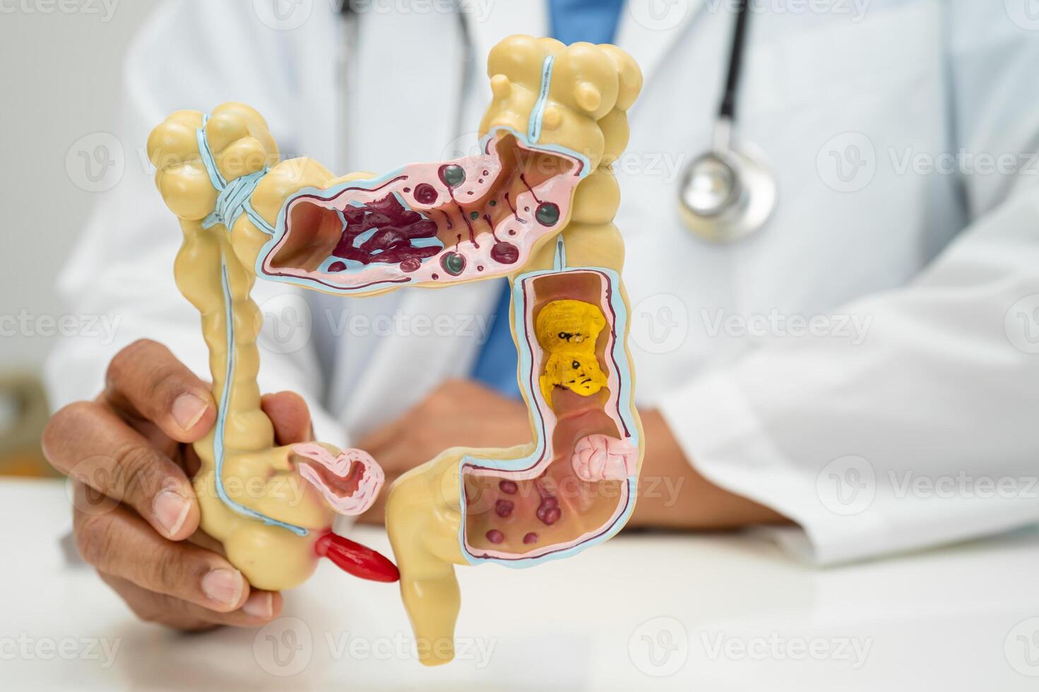 Intestine, appendix and digestive system, doctor holding anatomy model for study diagnosis and treatment in hospital. photo