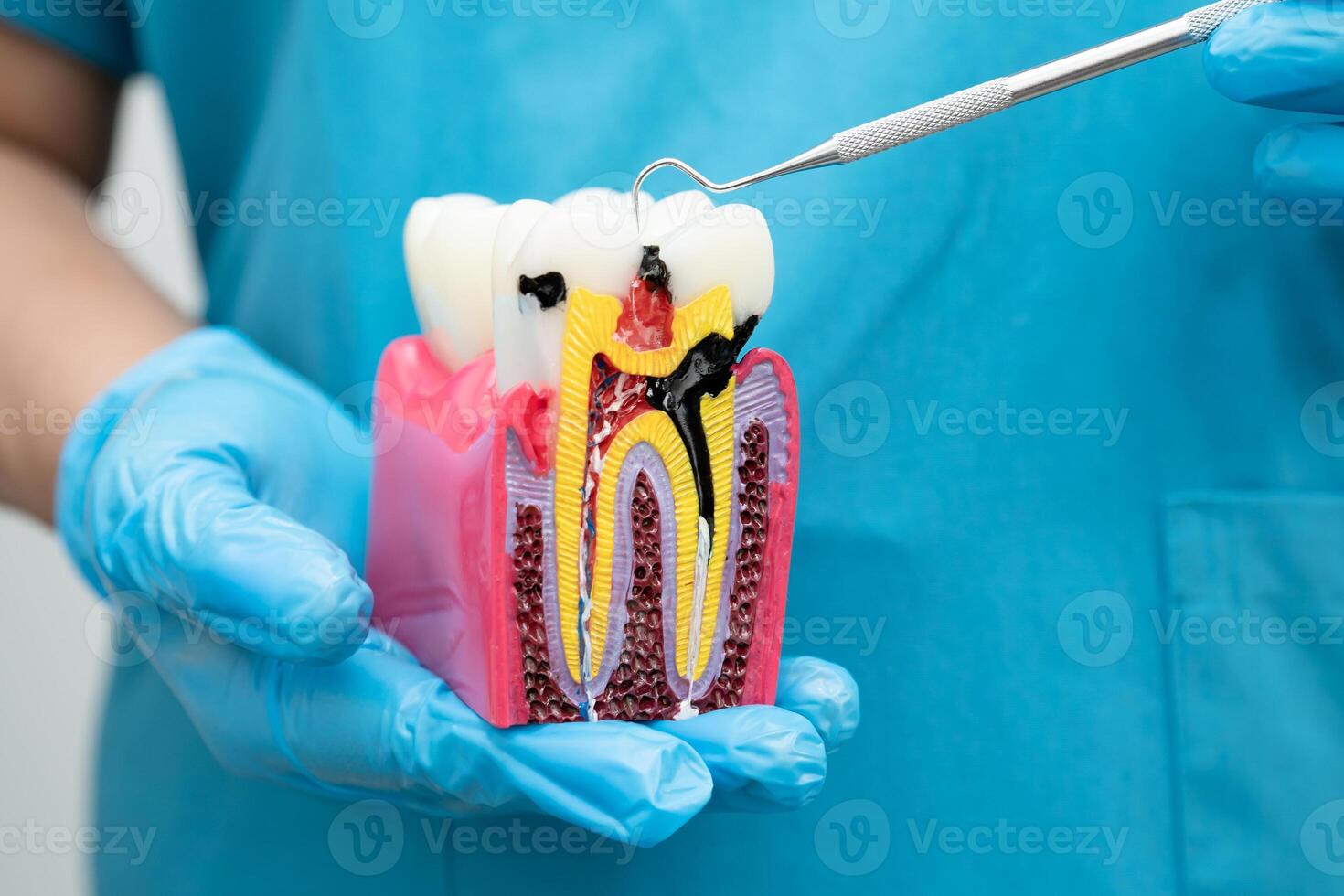 Asian dentist holding dental implant, artificial tooth roots into jaw, root canal of dental treatment, gum disease, teeth model for dentist. photo