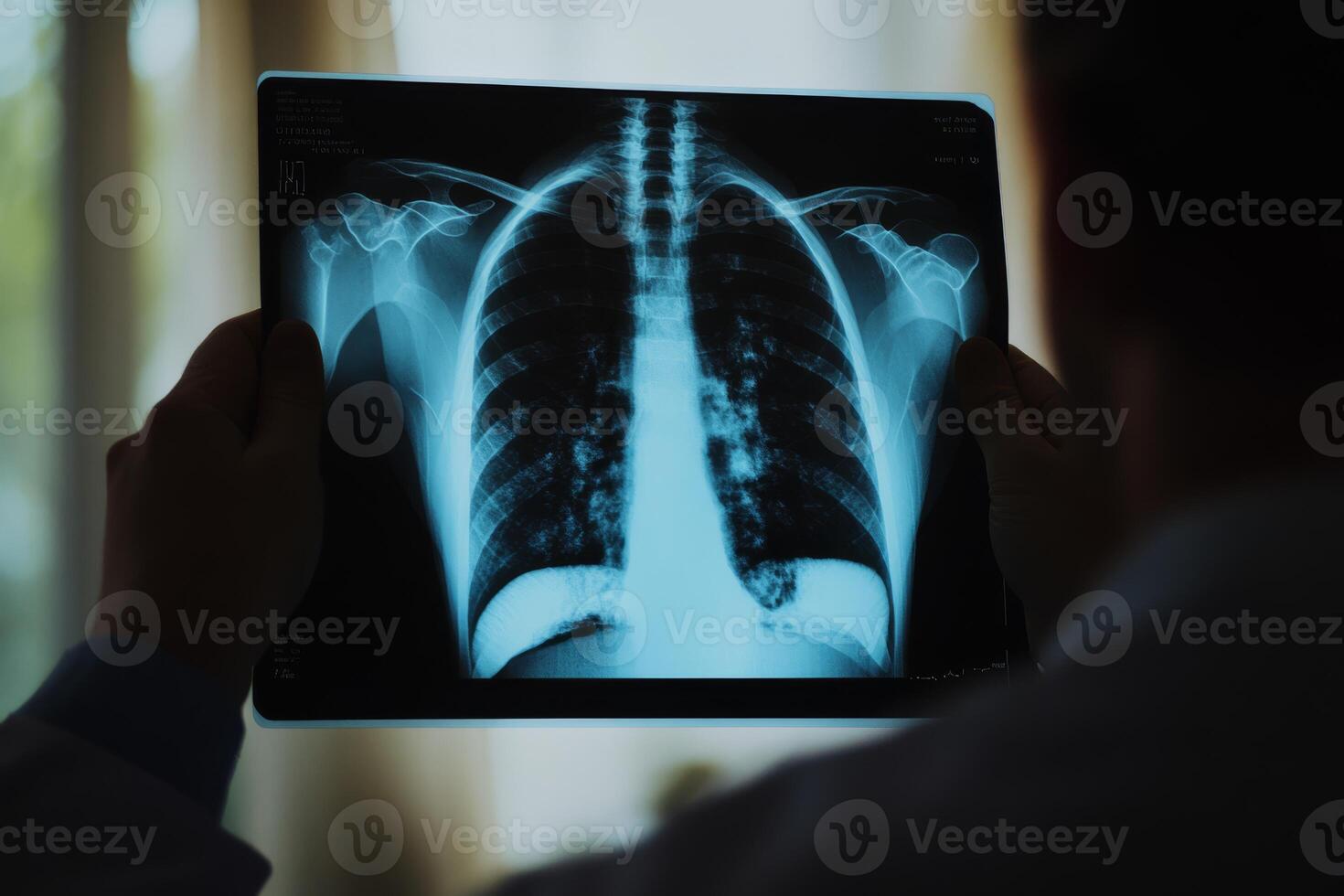 In a welllit clinical space, a dedicated healthcare professional examines a chest Xray, highlighting the vital role of radiology in effective patient care and accurate diagnoses photo