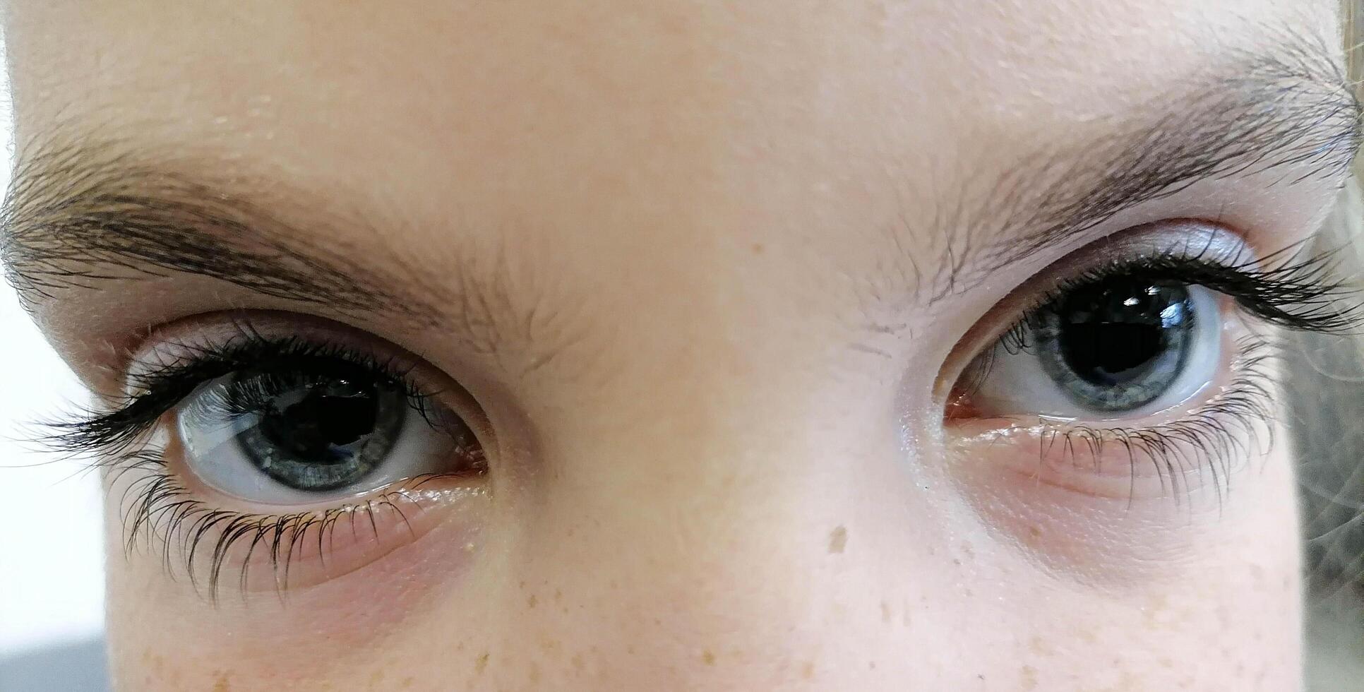 children's eye with dilated pupils photo
