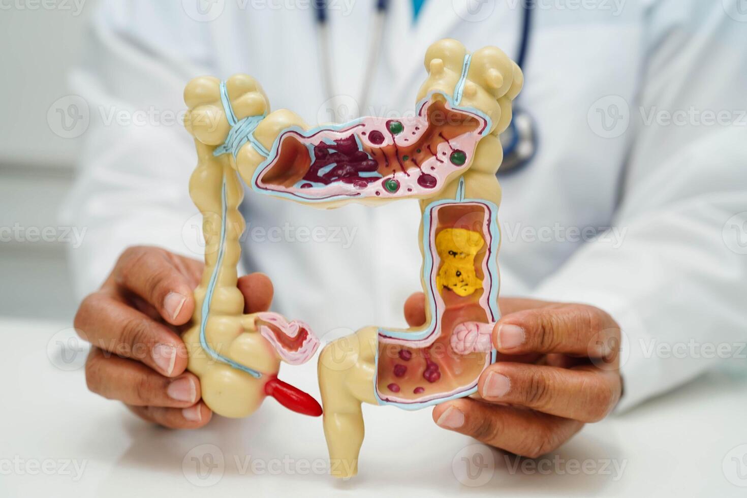 Intestine, doctor holding human anatomy model for study diagnosis and treatment in hospital. photo