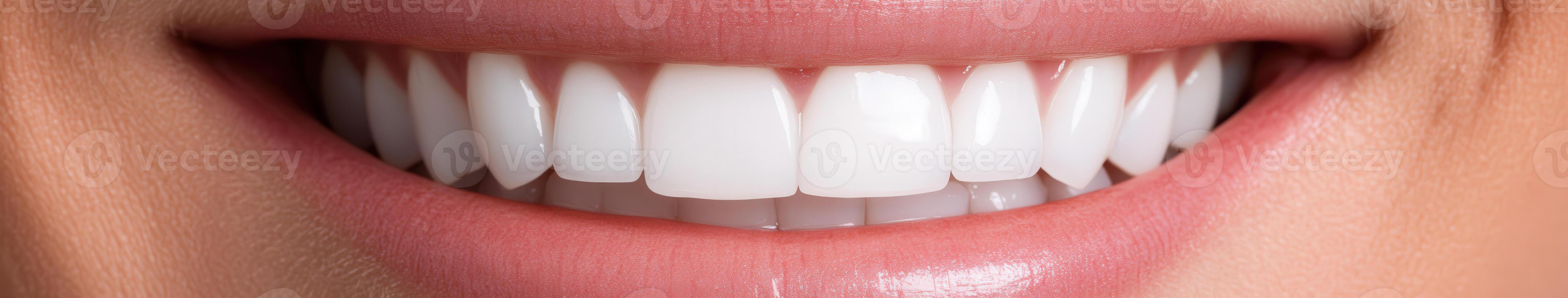 Bright smile showcasing perfect white teeth in close-up view photo