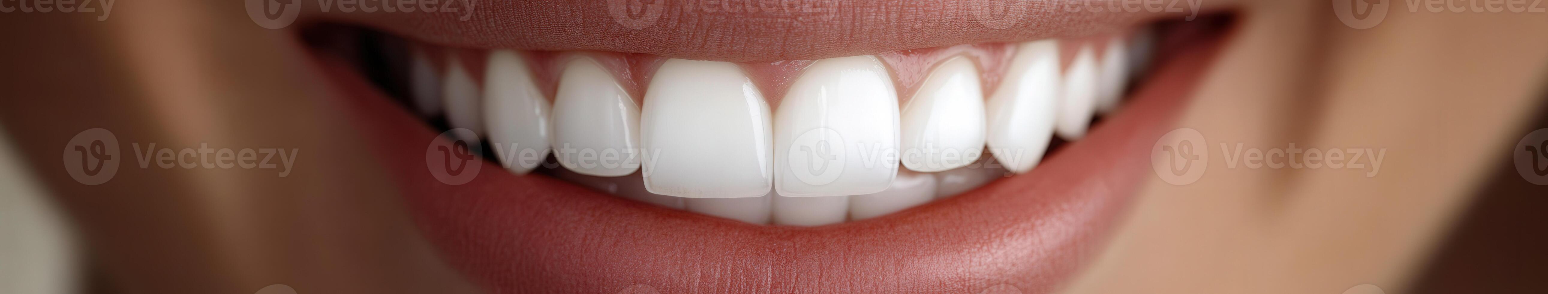 A close-up of bright, white teeth and a joyful smile of a person photo