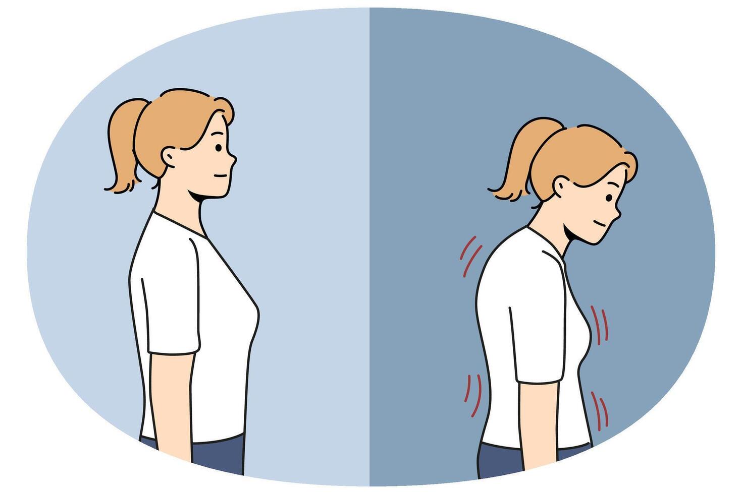 Stooped woman before and after correcting posture thanks to massage therapist or chiropractor vector