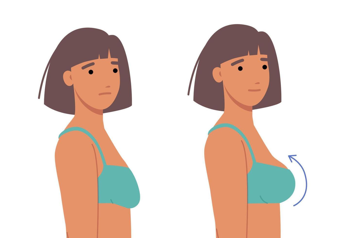 Woman had plastic surgery for breasts, inserting implants to increase size or improve firmness vector