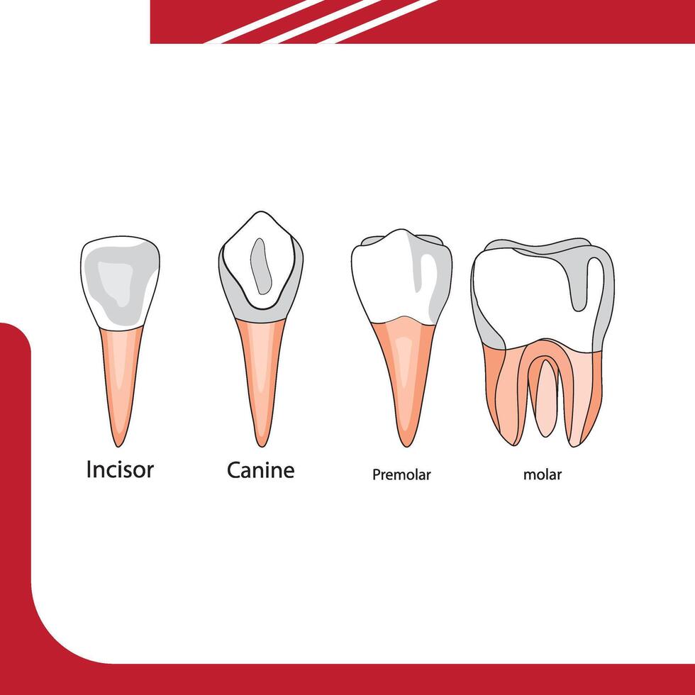 dental disease with pain and inflammation. tooth root inflammation, pulpitis. vector